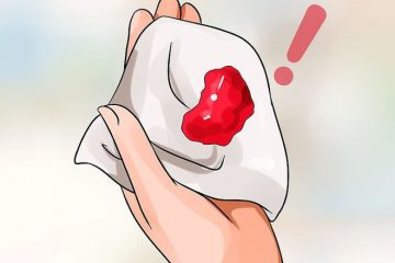 Khí hư có lẫn tia máu là dấu hiệu cảnh báo bệnh lý nguy hiểm nào? – Cách điều trị