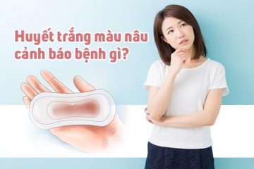 Thận trọng với khí hư màu nâu – dấu hiệu cảnh báo bệnh lý nguy hiểm