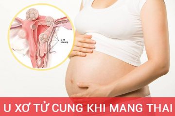 U xơ tử cung khi mang thai: nguyên nhân, triệu chứng, cách điều trị